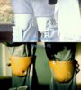 ST-PP1 Knees.jpg